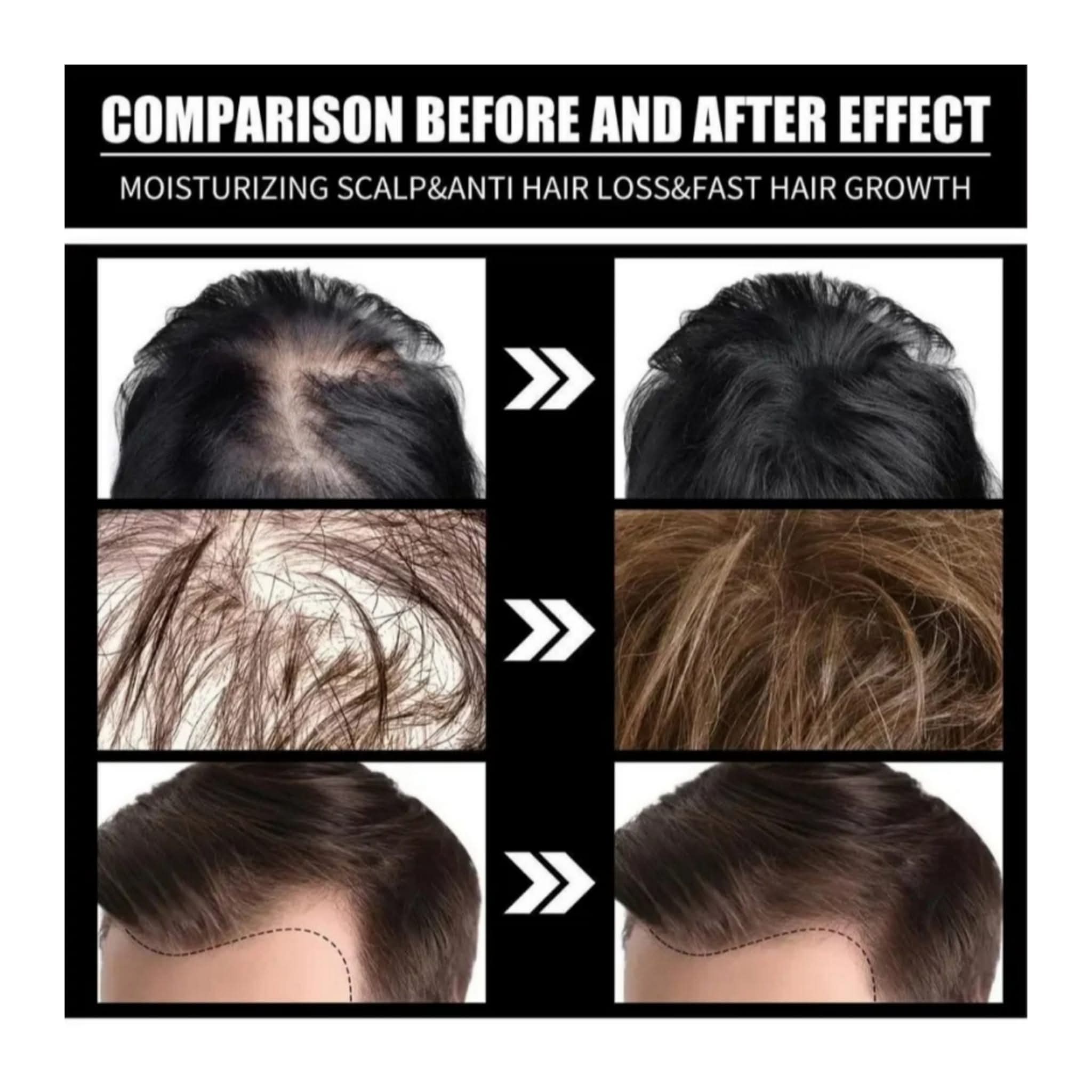 7 in 1 herbel hair oil