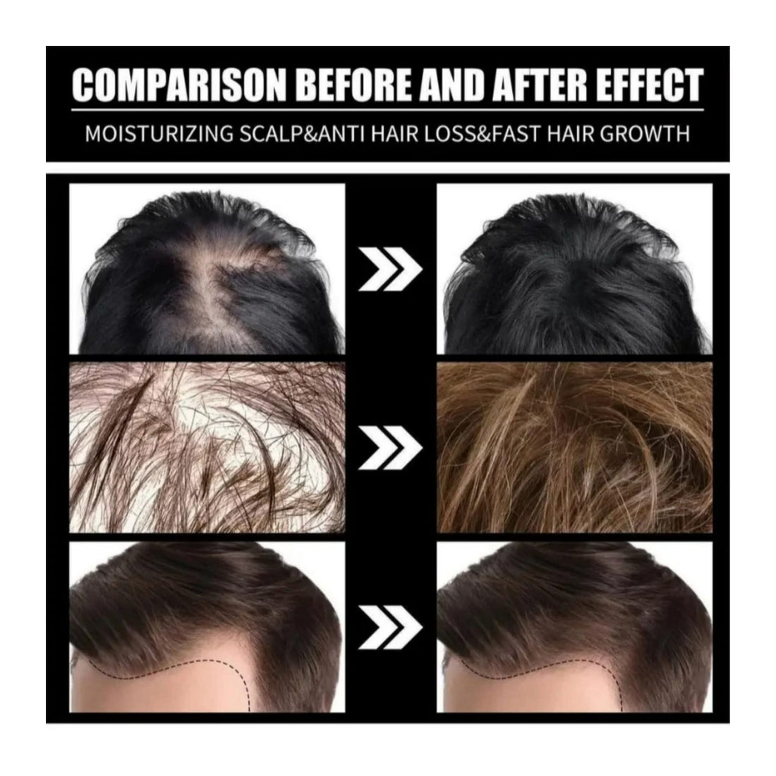 7 in 1 herbel hair oil